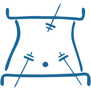 Laparoscopic Surgery